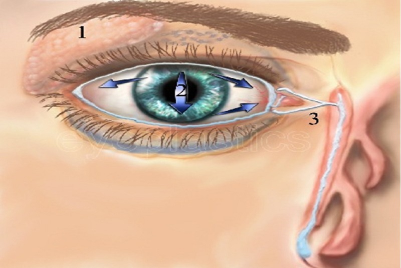 Khô mắt là một trong các nguyên nhân gây nên tình trạng ngủ dậy mắt bị mờ
