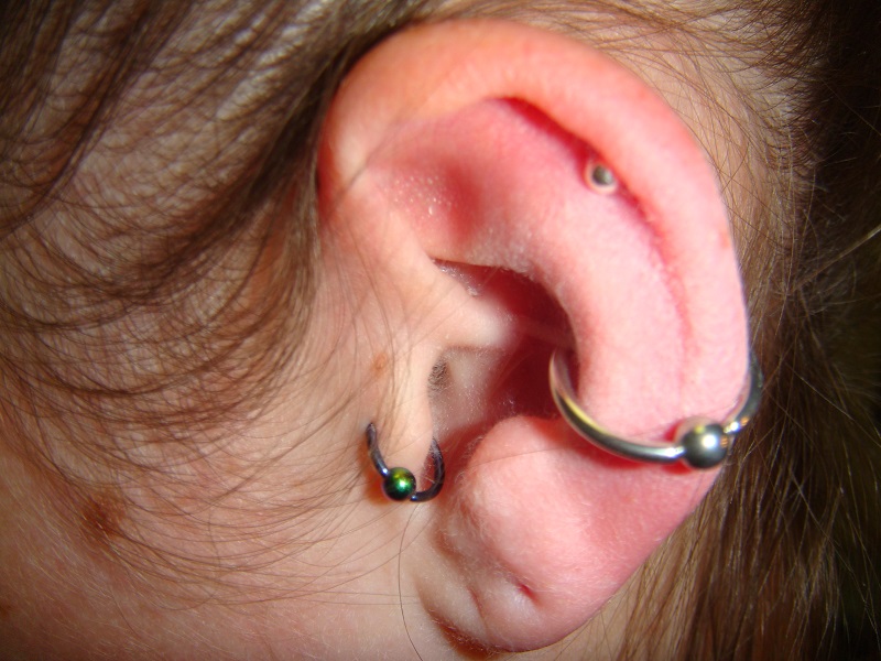 Bấm lỗ tai bị sưng do nhiều nguyên nhân gây ra