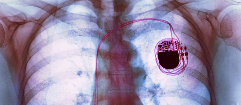 Những vật dụng điện tử nào mà người đang sử dụng máy tạo nhịp tim cần tránh để không gây ảnh hưởng đến hoạt động của máy?
