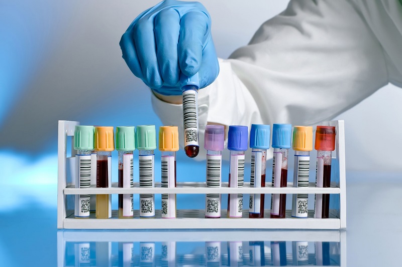 Xét nghiệm sinh hóa máu là một công cụ không thể thiếu trong y học hiện đại