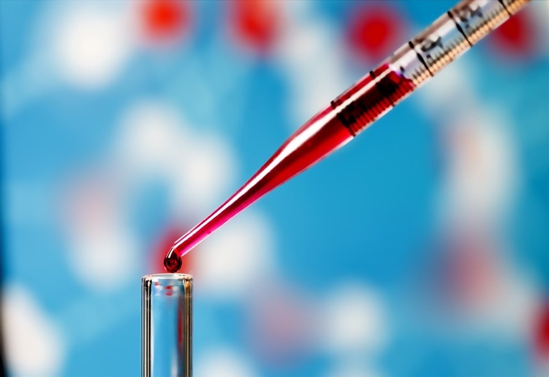 Xét nghiệm máu để xác định số lượng tiểu cầu trong máu
