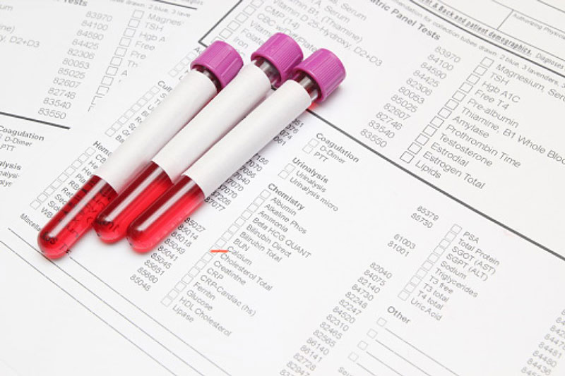 Chúng ta nên xét nghiệm sinh hóa máu khi kiểm tra sức khỏe định kỳ