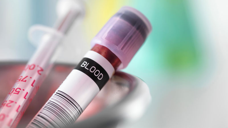 Xét nghiệm sinh hóa máu kiểm tra hoạt động của 2 cơ quan quan trọng là gan và thận.