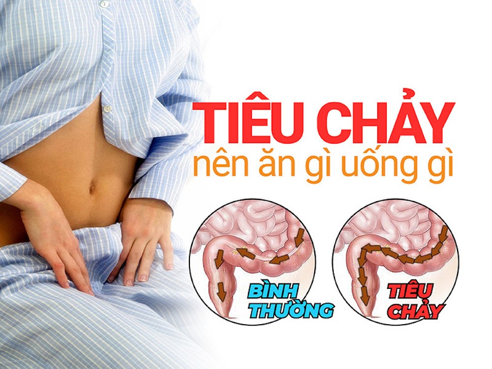 Đau bụng tiêu chảy không nên ăn gì? Những thực phẩm cần tránh để nhanh hồi phục