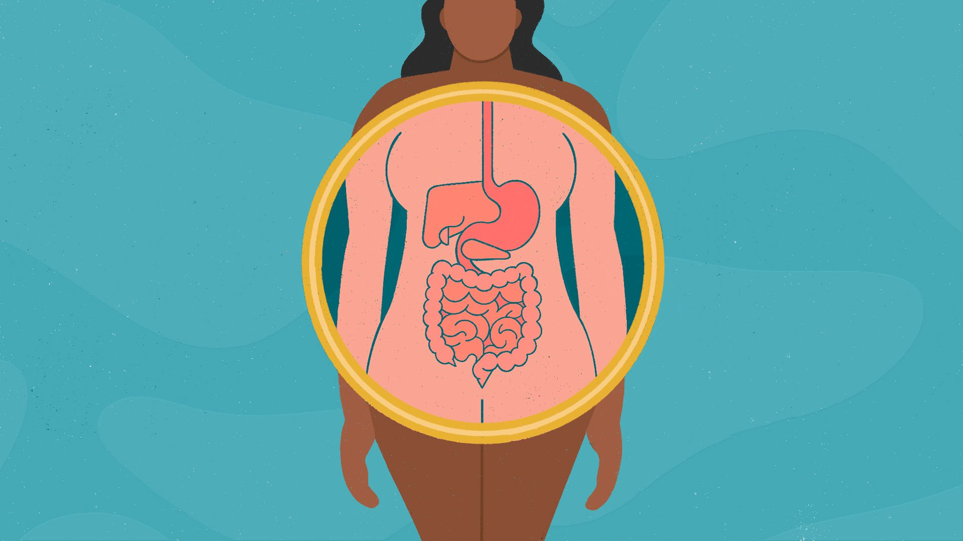 Ăn xong đau bụng đi ngoài có thể là biểu hiện của hội chứng ruột kích thích