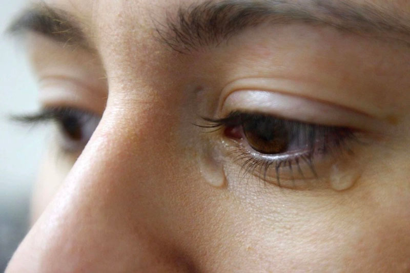 Mắt hay bị cay và chảy nước mắt do nhiều nguyên nhân khác nhau