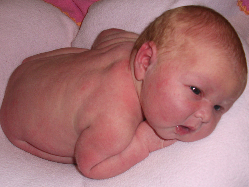 Mẹ cần hỏi ý kiến bác sĩ khi sử dụng nguyên liệu tự nhiên tắm cho bé khi bị rôm sảy