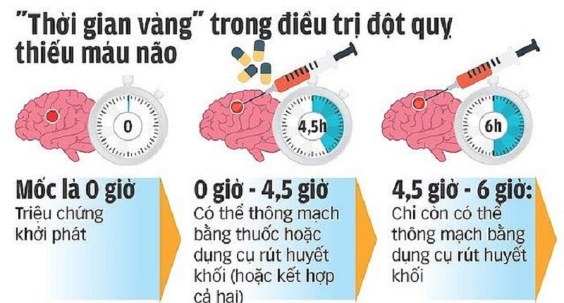 Mô phỏng về tầm quan trọng của cấp cứu thời gian vàng trong đột quỵ