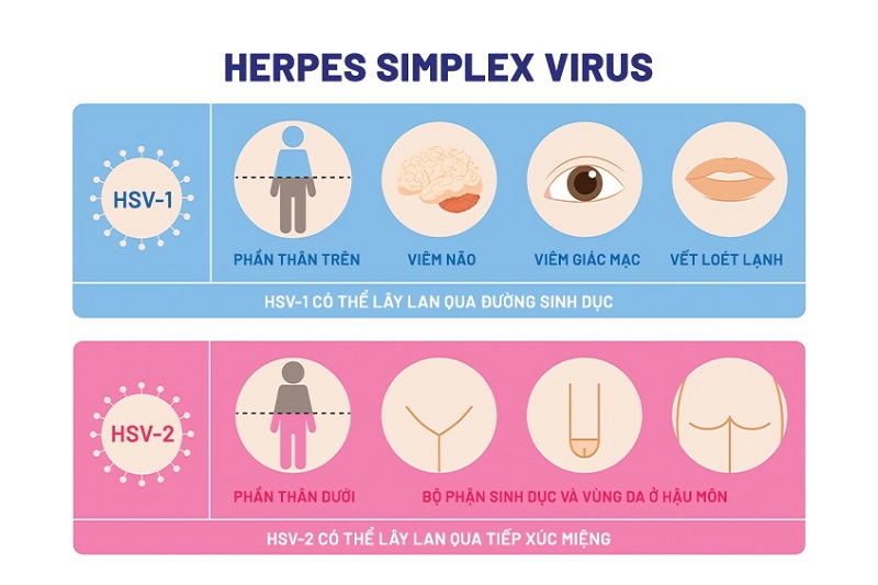 2 chủng HSV gây nên bệnh herpes sinh dục