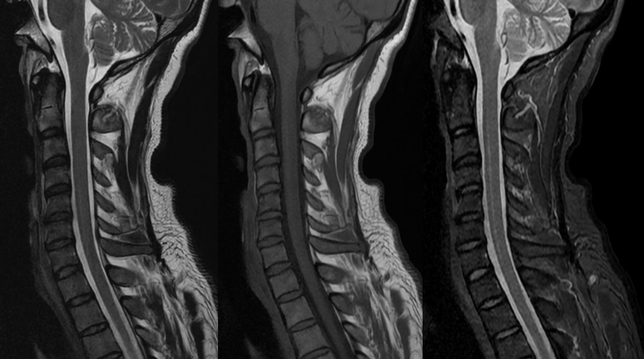 Chụp MRI giá thế nào