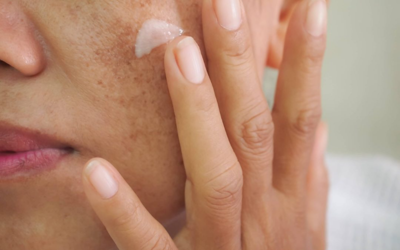 Kem trị nám giúp làm mờ và giảm thiểu sự xuất hiện của vết nám trên da