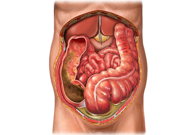Phúc mạc là một lớp mỏng tế bào biểu mô, bảo vệ các cơ quan trong ổ bụng