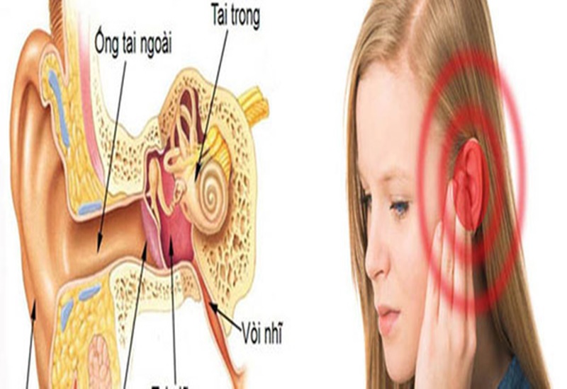 Tế bào ung thư có thể xuất hiện ở nhiều vị trí của tai