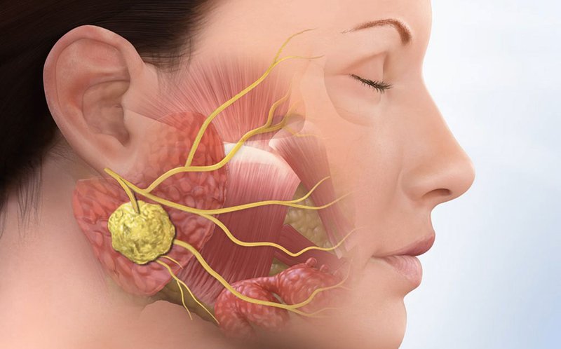 Đâu là các dấu hiệu và triệu chứng của bị tổn thương dây thần kinh vùng hàm mặt?

