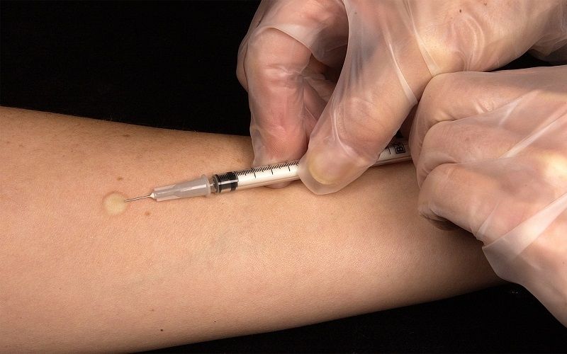 Tiêm trong da nhằm test phản ứng của thuốc hay vaccine trước khi đưa vào cơ thể