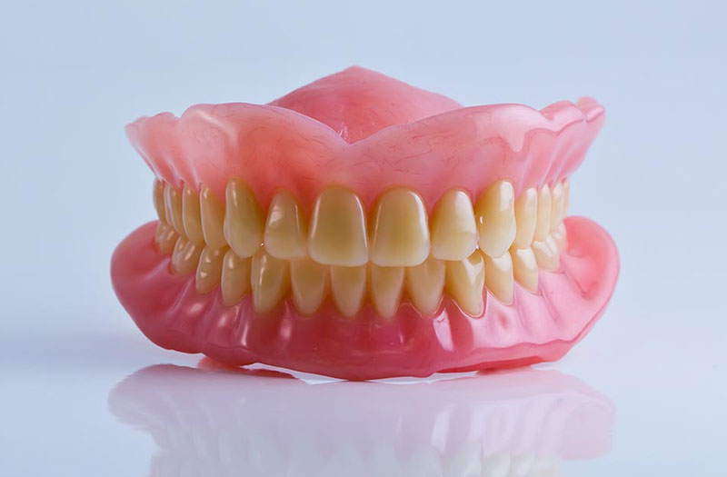  Hàm răng giả : Một giải pháp hoàn hảo cho hàm răng thiếu
