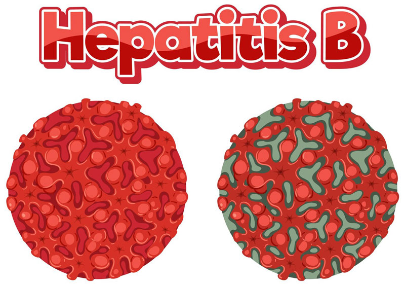 Virus HBV (Hepatitis B Virus) làm nhiễm trùng gan, là tác nhân gây viêm gan B