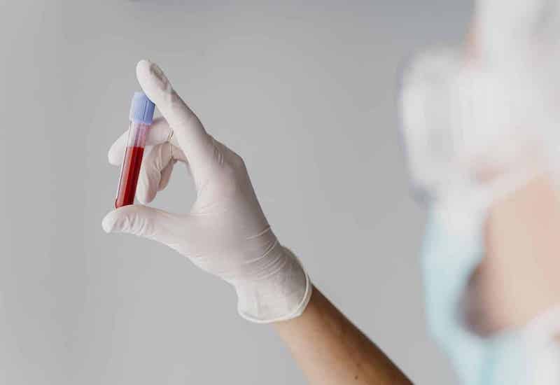 Các loại xét nghiệm máu sẽ giúp chẩn đoán nguyên nhân dẫn đến tỷ lệ bạch cầu trung tính tăng