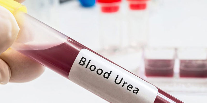 Xét nghiệm Ure máu được khuyến khích thực hiện vào buổi sáng