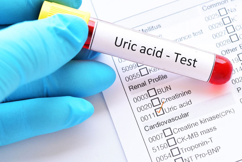 Xét nghiệm acid uric giúp đánh giá chức năng thận.