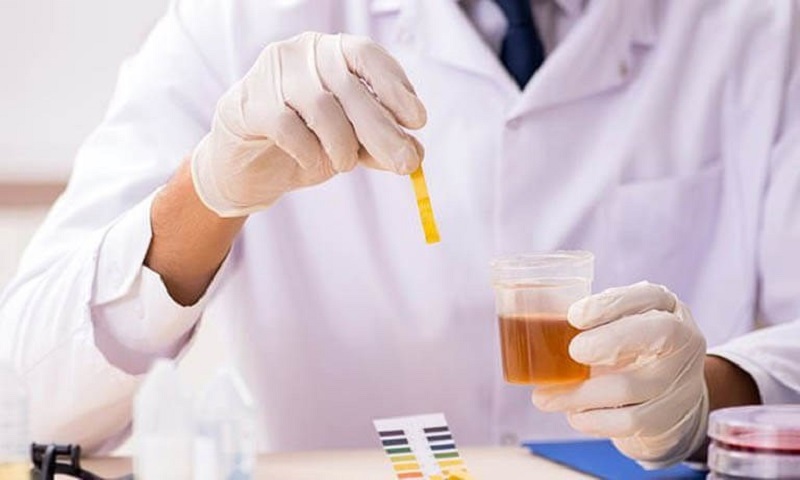 Xét nghiệm nước tiểu là kiểm tra thường quy có mặt ở mọi quy trình khám sức khỏe