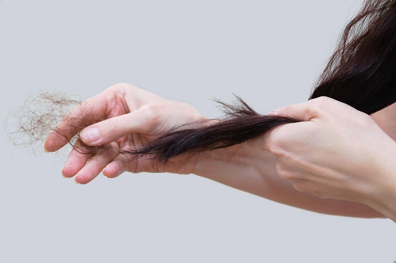 6 nguyên nhân gây rụng tóc ở nữ giới