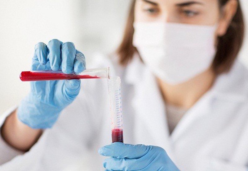  Xét nghiệm máu phát hiện bệnh gì : Tìm hiểu về quá trình và ý nghĩa của xét nghiệm máu