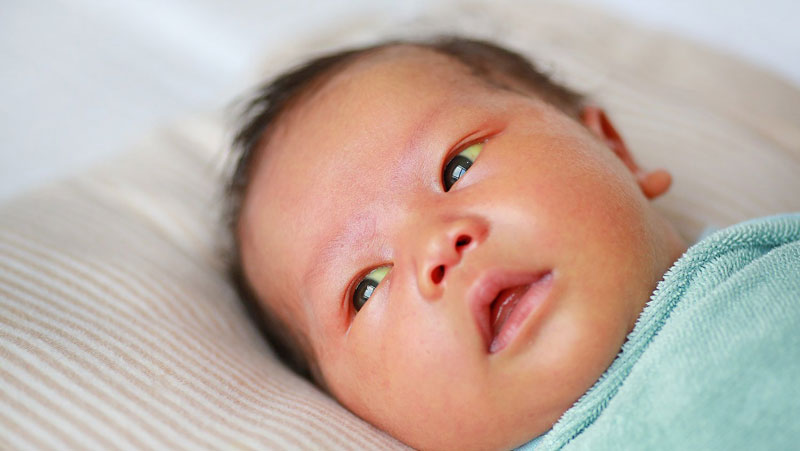Vàng da là hiện tượng thường gặp ở trẻ sơ sinh