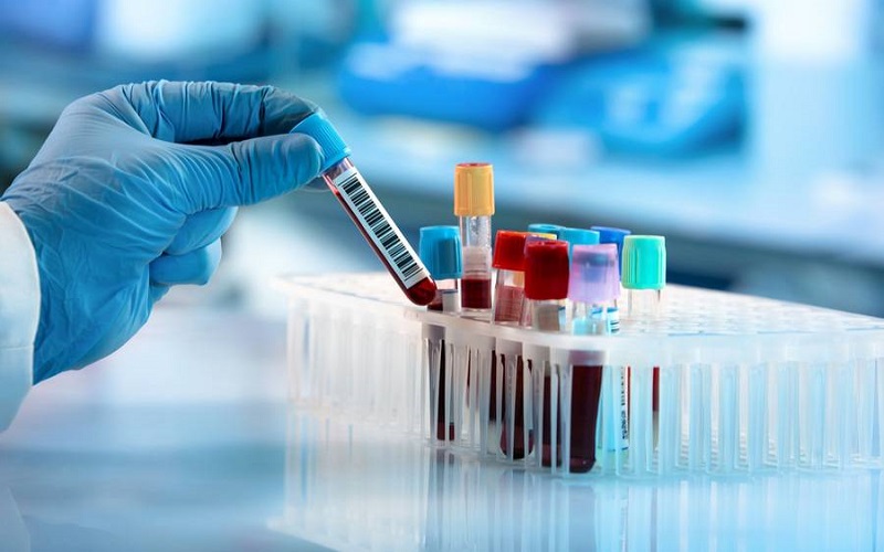 Có nhiều loại xét nghiệm máu khác nhau được chỉ định thực hiện theo mục đích cụ thể