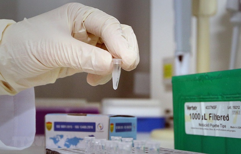 Xét nghiệm RT-PCR có độ chính xác cao nhất trong phát hiện cúm A