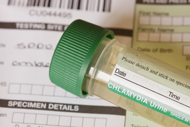 Xét nghiệm Chlamydia là phương pháp hiệu quả để sớm phát hiện bệnh