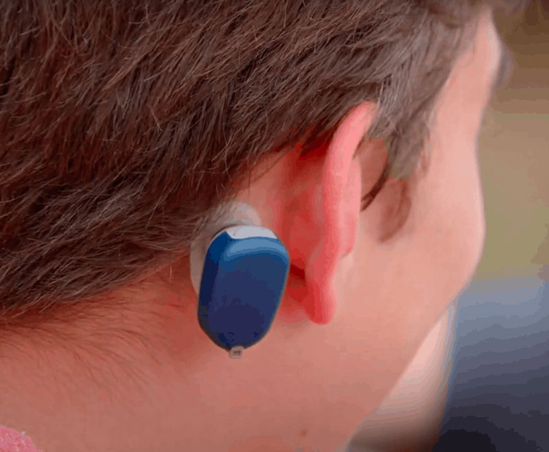 Các thiết bị hỗ trợ thính giác có thể được sử dụng