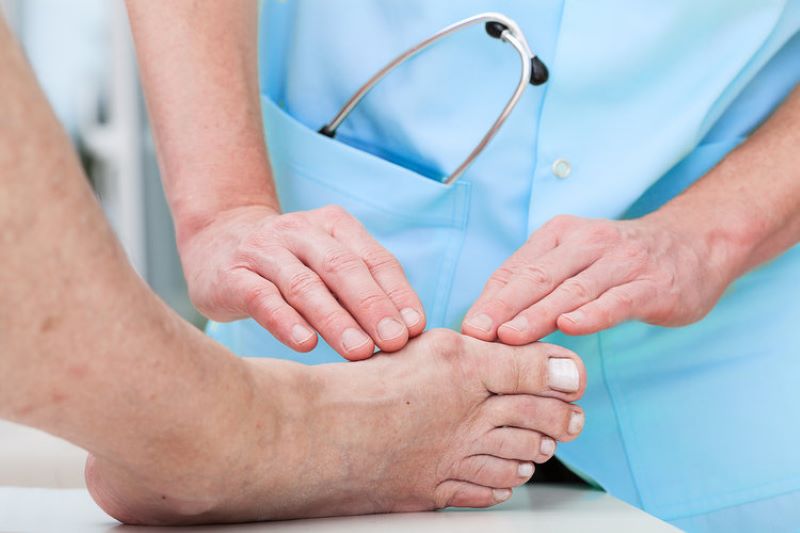 U nổi ở chân có thể là triệu chứng của bệnh gout