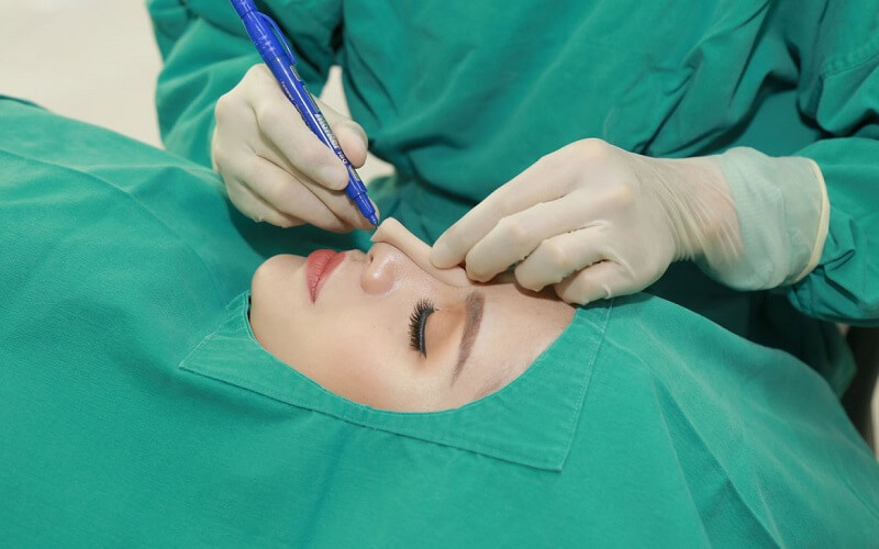 Lựa lựa chọn vị trí đáng tin tưởng nhằm triển khai phẫu thuật nâng mũi