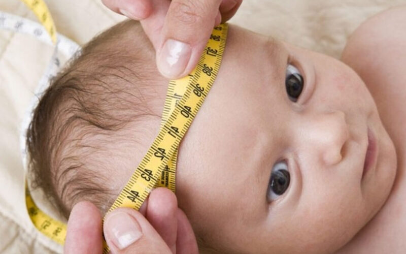 Cha mẹ nên đo vòng đầu của trẻ để phát hiện tăng kích thước bất thường và kịp thời thăm khám