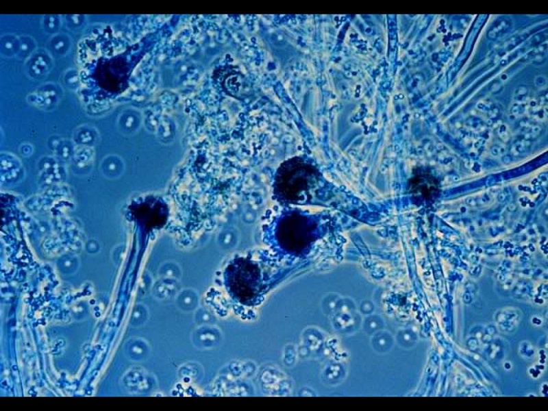 Nấm Aspergillus là tác nhân gây bệnh nấm phổi thường gặp nhất