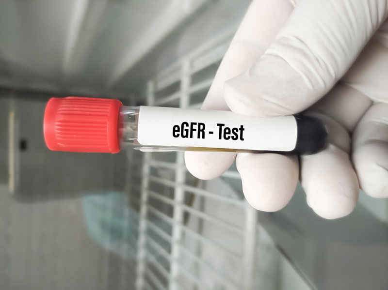 Quy trình xét nghiệm đột biến gen EGFR trải qua các bước 