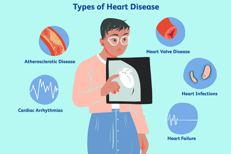 Có rất nhiều dạng bệnh tim mạch