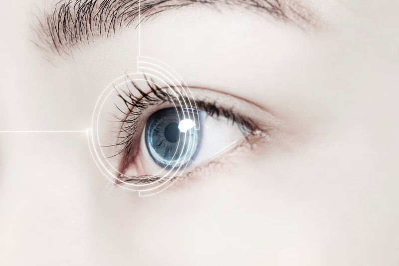 Phẫu thuật Lasik là kỹ thuật dùng tia laser để điều chỉnh lại độ cong giác mạc