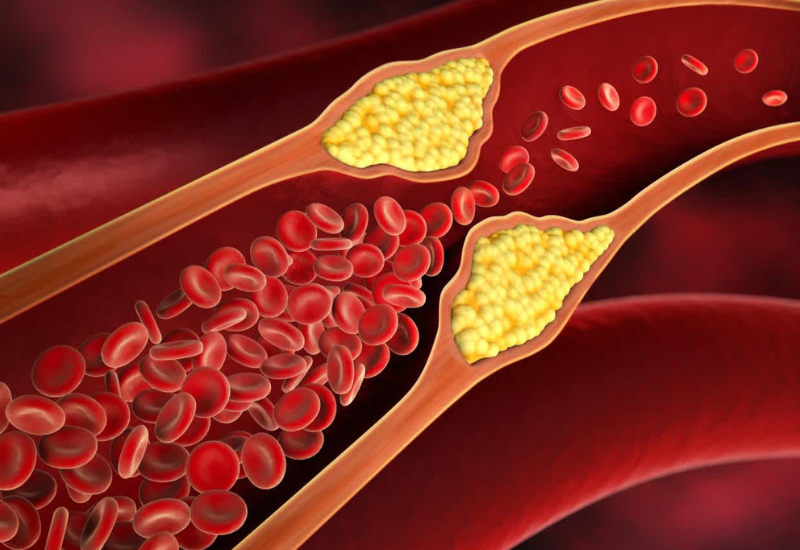 Cây thù lù có tác dụng làm giảm lượng cholesterol trong máu