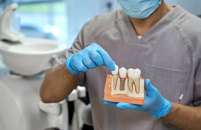 Chi phí trồng răng Implant từ 14.000.000 - 45.000.000 VND/chiếc