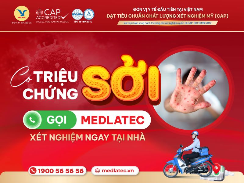 Dịch vụ xét nghiệm sởi tận nơi uy tín và chuyên nghiệp của MEDLATEC