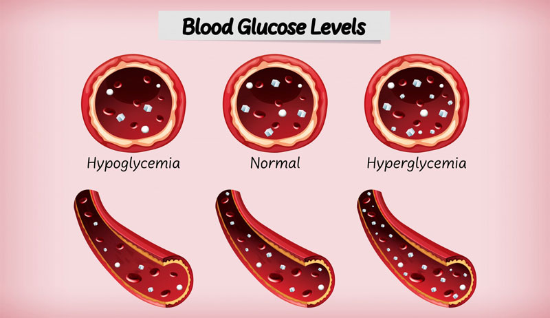 Chỉ số Glucose thường có trong kết quả xét nghiệm máu