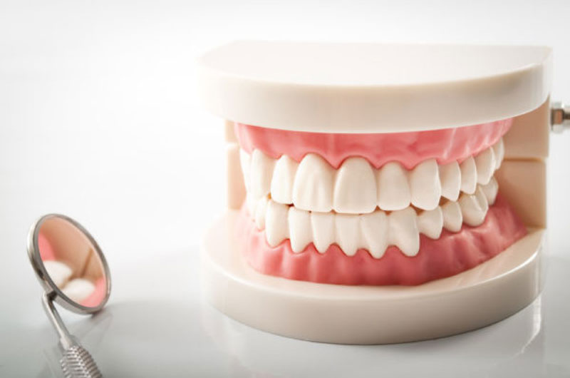 Trồng răng giả cố định có nhiều lợi ích hơn răng tháo lắp