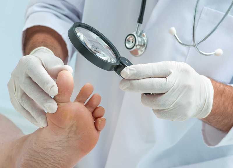 Móng chân có sọc đen kèm biểu hiện sưng tấy bất thường cần khám bác sĩ chuyên khoa để tìm ra nguyên nhân