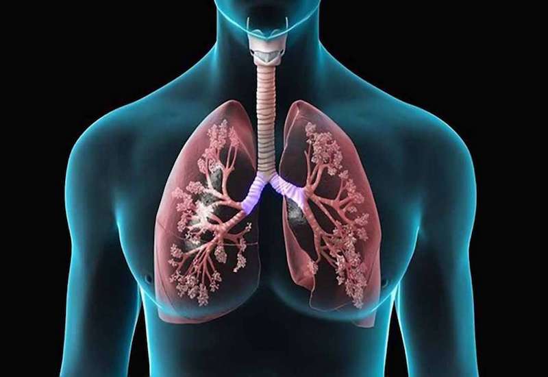 What are the symptoms of tuberculosis in the lungs without coughing?