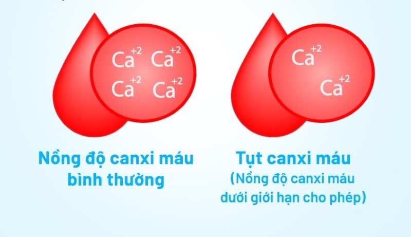 Hạ canxi máu xảy ra khi nồng độ canxi giảm dưới mức bình thường