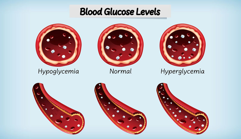 Xét nghiệm máu tổng quát có thể giúp kiểm tra lượng đường huyết, cholesterol trong máu