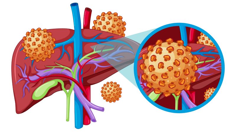 Khi virus HBV xâm nhập sẽ gây tổn thương tế bào gan làm suy giảm chức năng