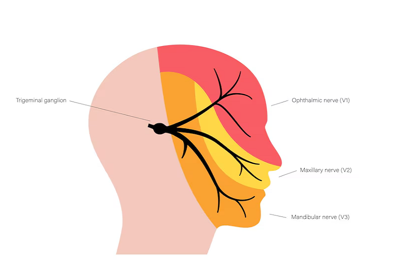 Mô phỏng vị trí xảy ra các cơn đau dây thần kinh số 5